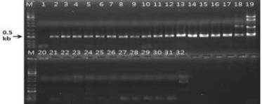 fub10f/r 프라이머를 이용한 후자린산 유전자 증폭