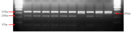 국내 분리주의 IS1311 PCR-REA를 이용한 type 분석