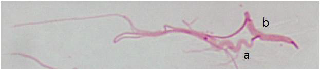 The staining patterns of two normal acrosomal morpholgies at sperm head The S-shape movement of head (a) and linear non-moving head (b) could be used as a marker of live/death sperm ratio.
