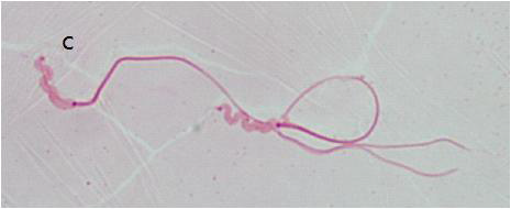 The image of chicken sperm with shorten acrosome in the head (c)