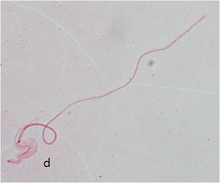 The image of chicken sperm with abnormal head This sperm head slightly swelled up in the junction part of flagellum (d) just before ruptures.