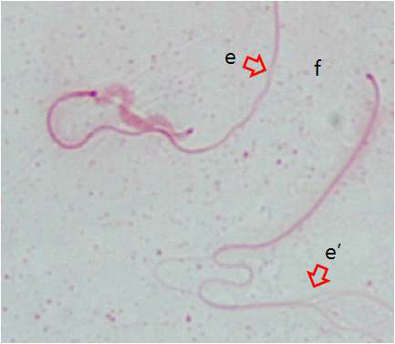 The image of chicken sperm with abnormal flagella The flagella of spermatozoa show the shape of unwounded rope (e and e’)