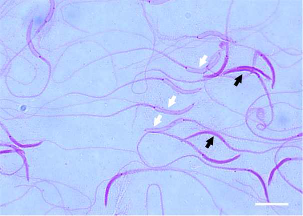 Ogye rooster spermatozoa assessed by Diff-Quik staining. Ogye spermatozoa with different staining intensities can be observed with a standard bright filed microscope, which include normal staining pattern (white arrow), and sperm with abnormal dark staining heads (black arrow). Measuring bar is 10 μm.