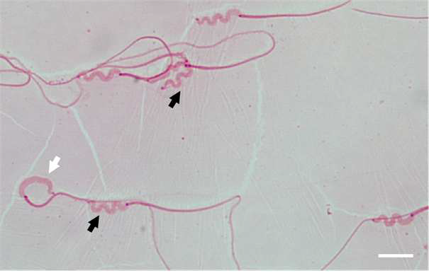 The image of moving heads in Ogye rooster activated fresh spermatozoa. The head of Ogye spermatozoa shows diffe- rent moving images, which includes non-moving head (white arrow) and moving head (black arrow). Measuring bar is 10 μm.