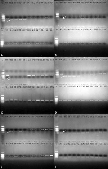 PCR-based markers for the discrimination of S. berthaultii from other Solanum species