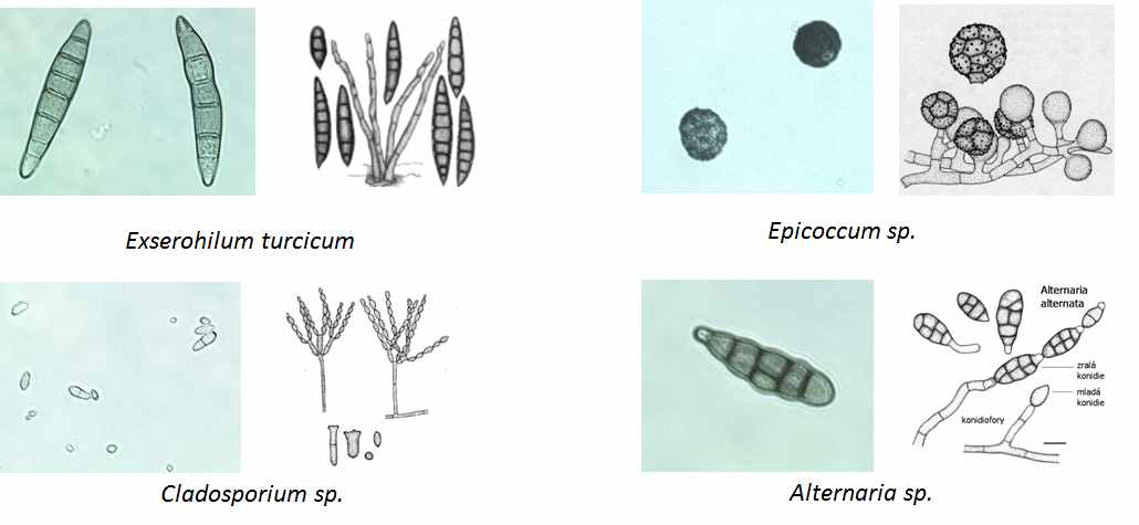 창춘 옥수수 재배지에서 분리된 병원균들의 포자 현미경 사진