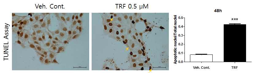 TUNEL assay