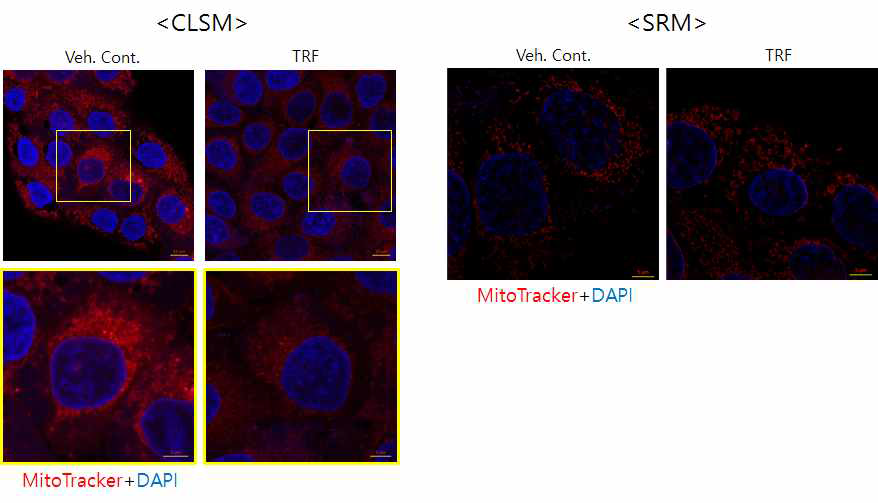 미토콘드리아의 MitoTracker CMXRos 염색상 변화