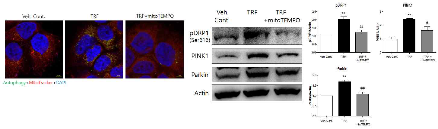 Autophagosome 염색과 Western blot을 통한 mitophagy detection