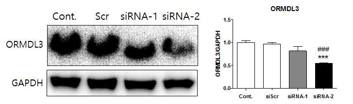 siORMDL3 transfection 효능 검정 및 조건 확립