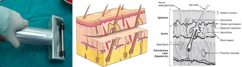 피부조직 및 dermatome