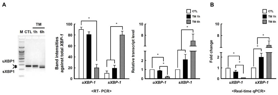 기존 band intensity법과 RT-PCR 방법을 통한 분석 결과 비교