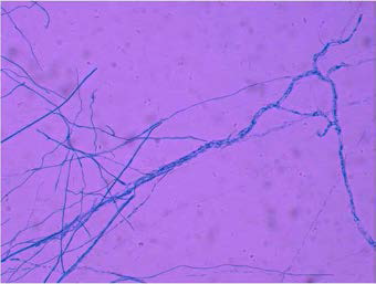 Bb18균(왼쪽)과 균핵병원균(오른쪽)의 slide glass culture한 모습