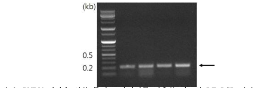 BYDV 진단을 위한 특이 프라이머를 이용한 시료의 RT-PCR 결과.
