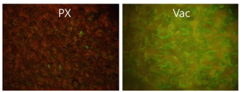 퍼옥시좀(PX)과 액포(Vac)에서 발현하는 subcellular organelle marker 형질전환체.