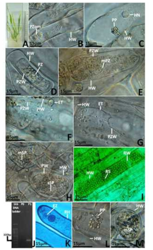 The morphological features of P. graminis at various developmental stages in barley root