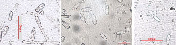 일당귀 흰가루병균(Erysiphe heraclei)의 분생자경과 포자.