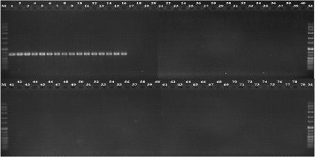 Agarose gel electrophoresis of PCR products from R. solanacearum strains using 18920 F  lane 1-79: R. solanacearum strains (number 1-79, respectively, in Table 6)