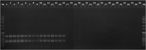 Agarose gel electrophoresis of a multiplex PCR product amplified from R. solanacearum strains and other Xanthomonas and Pseudomonas species. M, 1 kb size marker; lane 1-16: R. solanacearum strains (number 1-16, respectively, in Table 6); lanes 21-36: other Xanthomonas and Pseudomonas species (number 80-83, respectively, in Table 6).