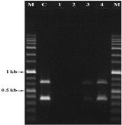 PCR assay for pathogen detection in potato leaf Sample up to 3 weeks after inoculation. Lane M: size marker (1 kb ladder; TNT Research, Korea); C, control Ralstonia solanacearum SL2029 gDNA(50 ng/ul); lanes 1-4: leaf sample, 4, 10, 14, and 21 days after infection.