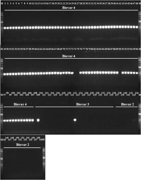 Agarose gel electrophoresis of PCR products from R. solanacearum strains using 3658 F6  lane 1-159: R. solanacearum strains (number 1-159, respectively, in Table 8).