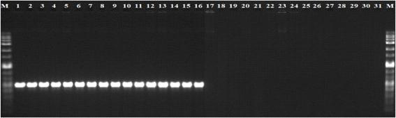 Agarose gel electrophoresis of PCR product amplified from R. solanacearum strains and other Xanthomonas and Pseudomonas species. M, 1 kb size marker; lane 1-19: R. solanacearum strains (number 1-19, respectively, in Table 9); lanes 20-31: other Xanthomonas and Pseudomonas species (number 20-31, respectively, in Table 9).