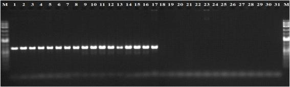 Agarose gel electrophoresis of PCR product amplified from R. solanacearum strains and other Xanthomonas and Pseudomonas species. M, 1 kb size marker; lane 1-19: R. solanacearum strains (number 1-19, respectively, in Table 11); lanes 20-31: other Xanthomonas and Pseudomonas species (number 17-31, respectively, in Table 11).