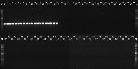Agarose gel electrophoresis of PCR products from R. solanacearum and Pseudomonas strains using 341-51200 F  lane 1-88: Ralstonia and Pseudomonas strians (number 1-88, respectievely, in Table 13).