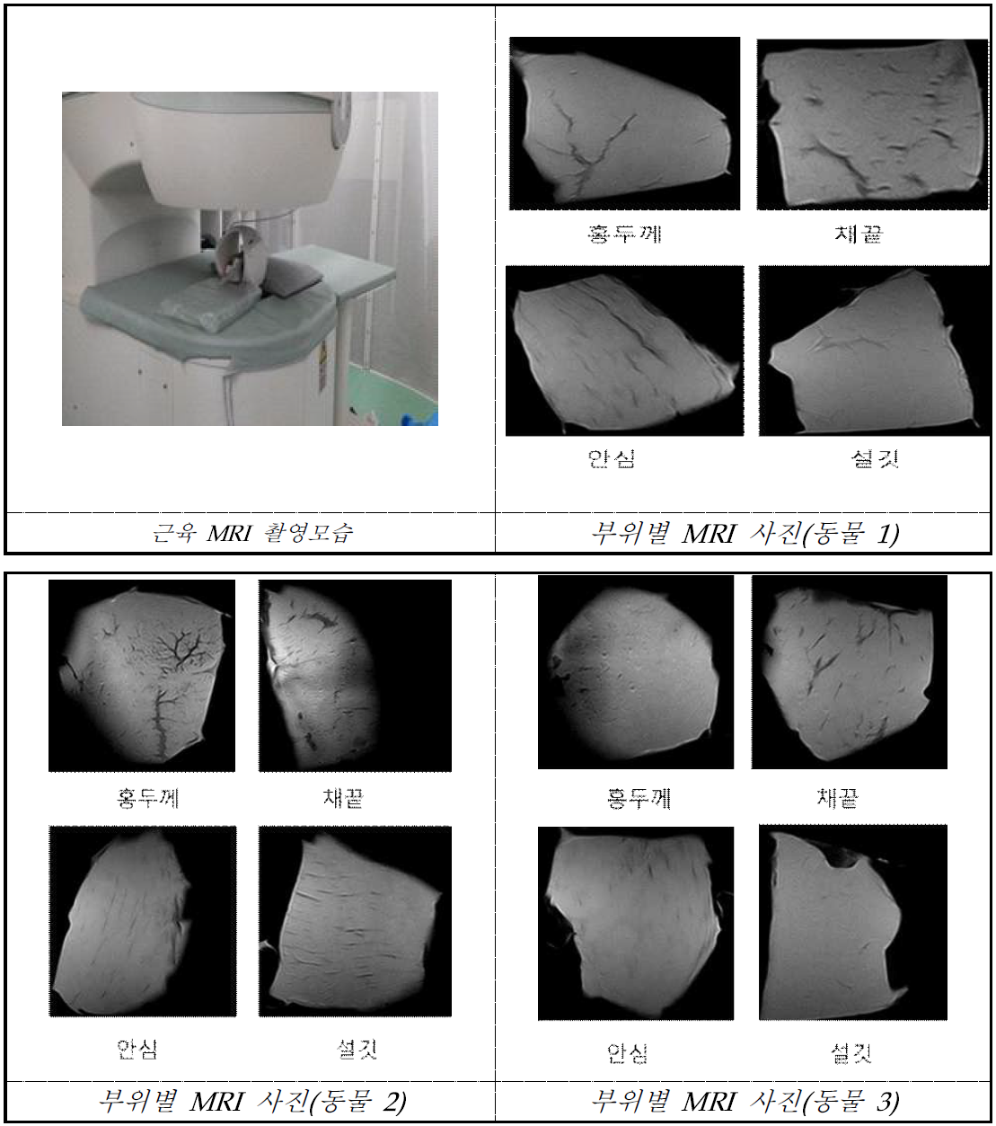 부위별 MRI 사진