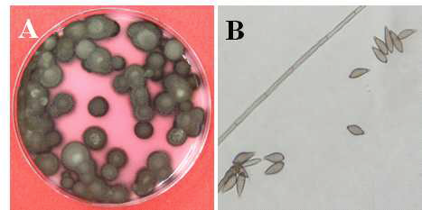 감자한천배지에서 20℃ 암상태로 30일 동안 혼합배양한 후 생성된 배나무 검은별무늬 병균 Venturia nashicola 균총(A) 및 분생포자(B).