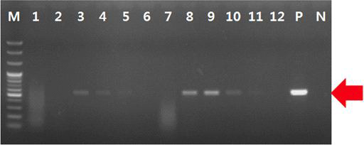 Amplification of ITS1, 2 - 5.8S region (550 bp) of Venturia nashicola with crude DNA extracted from diseased tissues of pear.