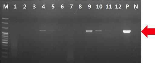 Amplification of β-tubulin gene (1263 bp) of Venturia nashicola with crude DNA extracted from diseased tissues of pear.