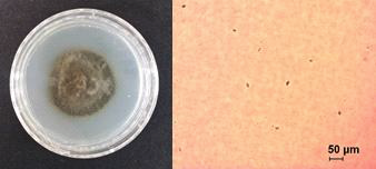 Colony of V. nashicola cultivated on PDA at 20℃ for 30 days (left) and conidial spores collected from naturally occurred lesions under microscope (right).