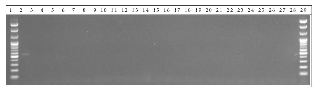 배양 분변 샘플 PCR. 1: Marker, 2: Positive control, 3: Negative control, 4-13: GM stool DNA 3 hr, 14-23: W.T stool DNA 3 hr, 24-28: non-treatment stool DNA 3 hr, 29: Marker