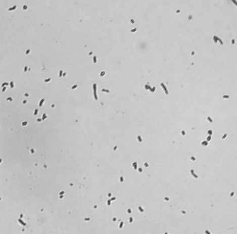 Lactobacillus reuteri의 Gram staining 결과