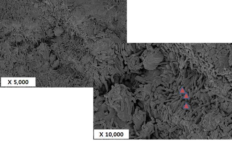 전자현미경으로 Hydroball에 고정된 Pseudomonas putida 확인