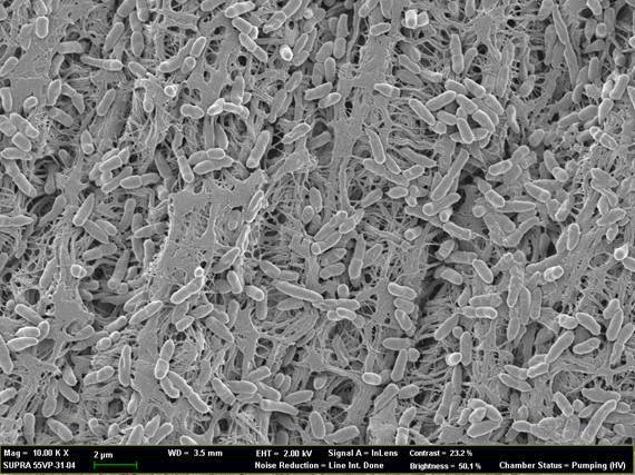 고정화된 미생물의 전자현미경 촬영사진 (x 10,000, Membrane filter+P. putida).