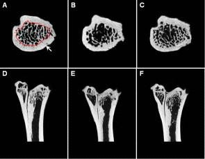 The cross sectional (upper panel; A, B and C) and transaxial (coronal section) images (lower panel; D, E and F) of tibial distal part, using Micro-CT analysis