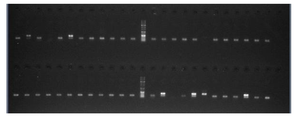 cylA, asa1, gelE 유전자 PCR 반응 후 전기영동 사진
