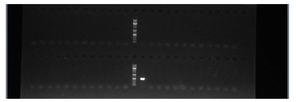 esp 유전자 PCR 반응 후 전기영동 사진