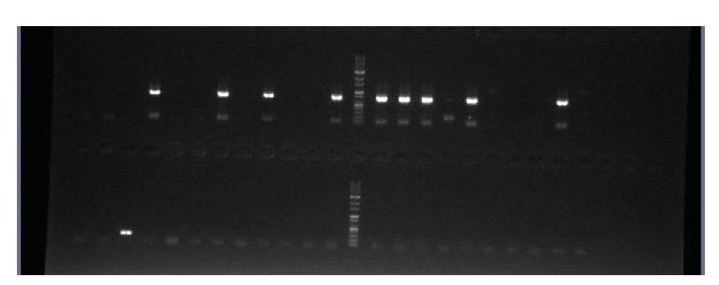 tet계열 유전자 PCR 반응 후 전기영동 사진