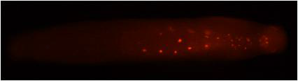 In situ hybridization 발현 양상