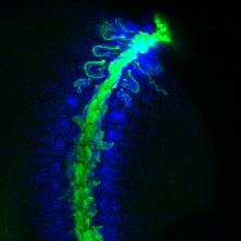 E.andrei mid early-stage embryo에서 나타나는 metanephridia