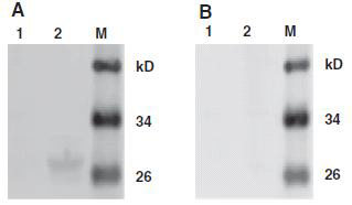 The epitope M14 could differentiate PEDC-positive serum from TGEV-positive serum