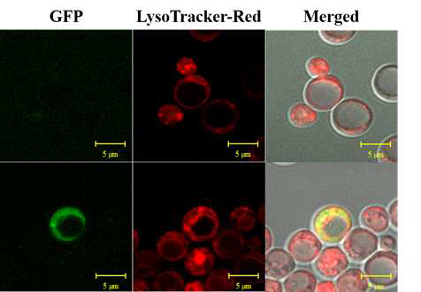 효모 리소좀의 녹색형광단백질의 발현. 윗부분은 pYES2 플라스미드만 포함된 균주, 아랫부분은 pYES2::VPS9::GFP 플라스미드가 포함된 재조합 균주