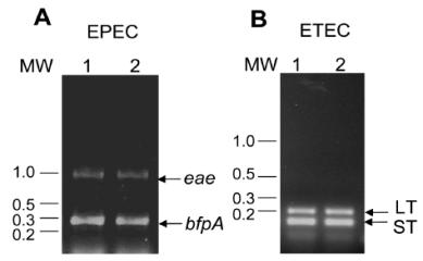 Crude DNA preparations versus bacterial suspension templates for use with the PCR assay