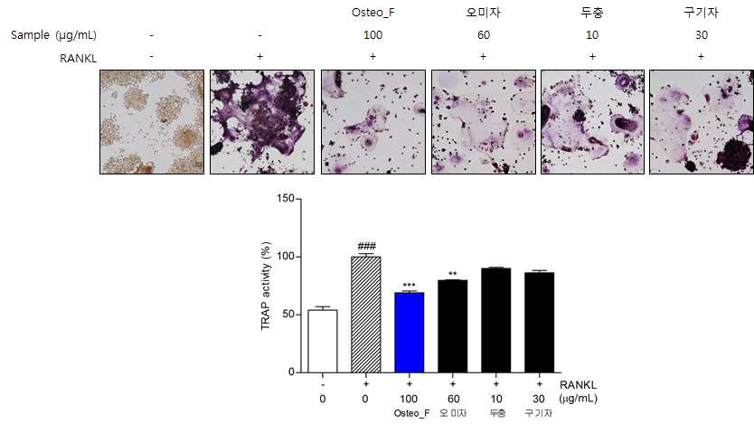 Osteoclast differentiation of Raw 264.7 cells