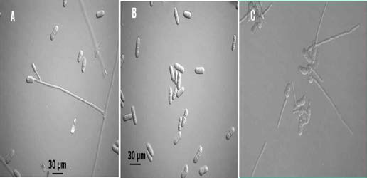 솜털곰팡이병원균 균사 및 포자 사진