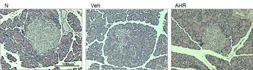 Histological observation of pancreas by hematoxylin and eosin staining in pancreatic tissue of streptozotocin-induced type 1 diabetic rats