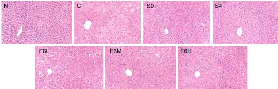 Histological observation of liver by hematoxylin and eosin staining in C57BL/KsJ-db/db mice fed water extracts of AHR for 8weeks.